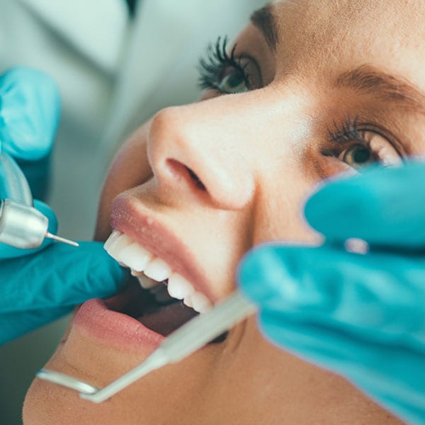 Cosmetic Bonding Services - Dental Clinic Bendigo