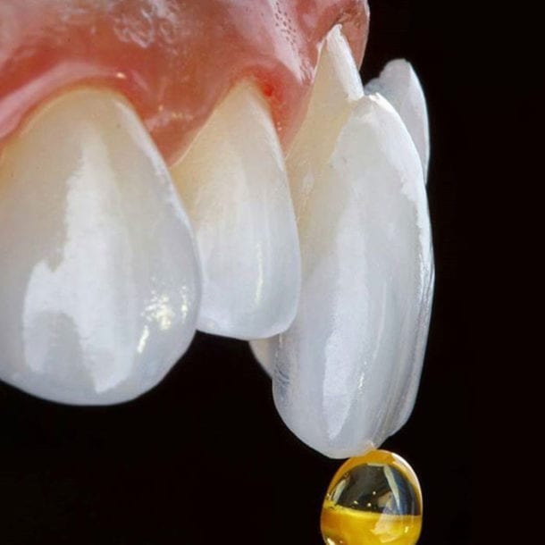 Porcelain Veneers Service - Dentist in Bendigo
