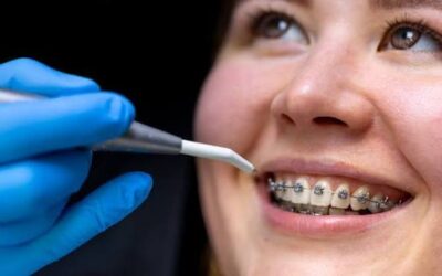 Top Reasons to Visit an Orthodontist in Bendigo for Teeth Straightening