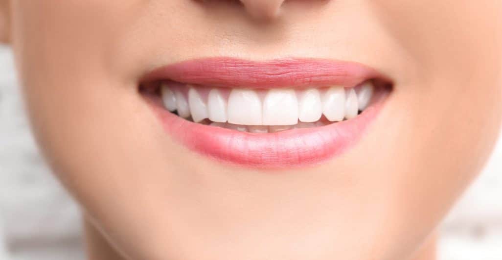 Thinking About Cosmetic Bonding? Here’s What You Should Know